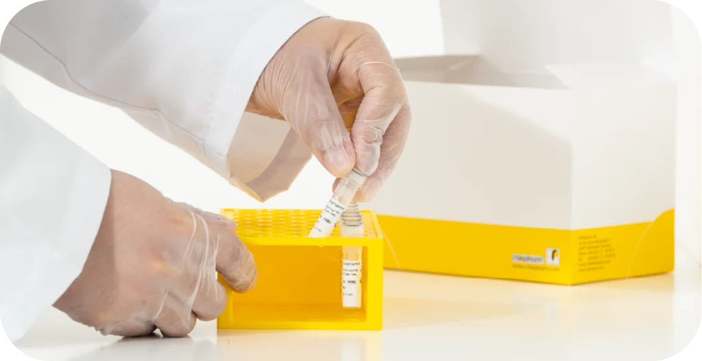 a man in a lab coat places a tube of liquid from the RIDA®PrepX Stool Kit a tray used for gastrointestinal testing